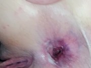 Luxusní anál sousedky 15/16