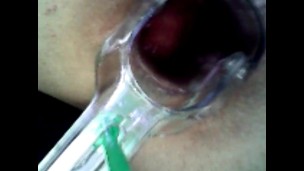 Deep look inside cum filled ass with endoscope