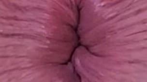 My winking ass hole