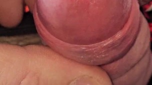 Pulling back my foreskin with a urethral plug