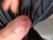 tight foreskin large cock play- playing with my uncut foreskin phimosis cock 1/16