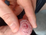tight foreskin large cock play- playing with my uncut foreskin phimosis cock 2/16