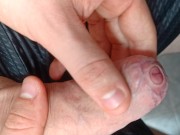 tight foreskin large cock play- playing with my uncut foreskin phimosis cock 7/16