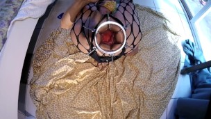 Anal Gyno