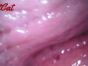 Endoscopic ♥vaginal observation内視鏡おまんこ♥膣内観察 10/16
