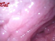 Endoscopic ♥vaginal observation内視鏡おまんこ♥膣内観察 11/16