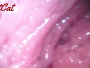 Endoscopic ♥vaginal observation内視鏡おまんこ♥膣内観察 13/16
