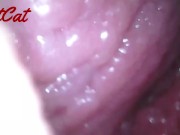 Endoscopic ♥vaginal observation内視鏡おまんこ♥膣内観察 14/16