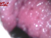 Endoscopic ♥vaginal observation内視鏡おまんこ♥膣内観察 15/16
