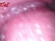 Endoscopic ♥vaginal observation内視鏡おまんこ♥膣内観察 16/16