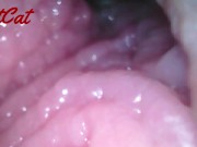 Endoscopic ♥vaginal observation内視鏡おまんこ♥膣内観察 3/16
