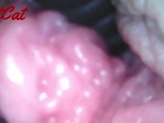 Endoscopic ♥vaginal observation内視鏡おまんこ♥膣内観察 4/16