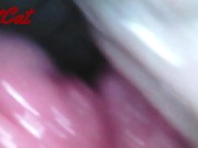 Endoscopic ♥vaginal observation内視鏡おまんこ♥膣内観察 5/16