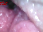 Endoscopic ♥vaginal observation内視鏡おまんこ♥膣内観察 7/16