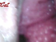 Endoscopic ♥vaginal observation内視鏡おまんこ♥膣内観察 9/16
