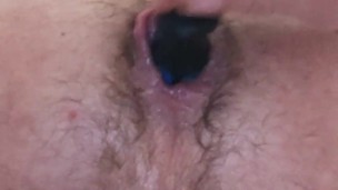 Anal gape