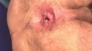 Homework gape