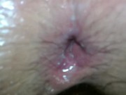 Milf whore fucked ass extreme anal filled with cum creampie 12/16