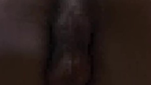 my anal