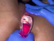 Pussy care  gynecologist speculum examination brought me to orgasm fluid examination 12/16