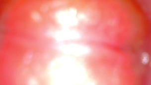 Camera Inside Pink Pussy Records A Huge Creampie From Within (Slow Motion Cumshot)