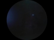 DP Endoscope for Andrew 13/16