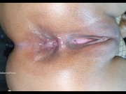 First time trying anal... This is how my ass turned out! 12/16