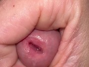macroprecum. - Screenshot 5 of 16 - Masajes