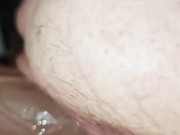 Hairy Milf Swallows Docs Cock & Creams On Huge Dildo 14/16