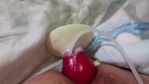 Knotting paraplegic ass