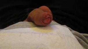 Masturbe (287) with one testicle