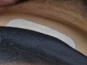 Nurse in the hospital surprises the patient after surgery 2/16