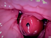 Camera in Vagina, Cervix POV, Tiny Cucked by Giant ‘Couple’, Cum in Condom and Creampie - Full Clip 11/16
