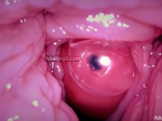 Camera in Vagina, Cervix POV, Tiny Cucked by Giant ‘Couple’, Cum in Condom and Creampie - Full Clip 12/16