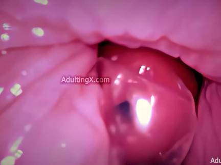 Camera in Vagina, Cervix POV, Tiny Cucked by Giant ‘Couple’, Cum in Condom and Creampie - Full Clip