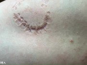 FemDom Biting Mistress Gets Her Teeth into her Sub - Deep Bites and Teeth Marks 11/16