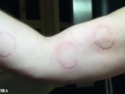 FemDom Biting Mistress Gets Her Teeth into her Sub - Deep Bites and Teeth Marks 12/16