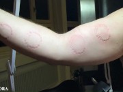 FemDom Biting Mistress Gets Her Teeth into her Sub - Deep Bites and Teeth Marks 13/16