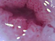 Cervix Throbbing, Dilated, Heartbeat, Extreme Close-up, Stunning, ASMR 10/16