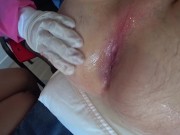 DAY 6.1: The nurses almost fought over my dick and ass. Public Crazy Place in hospital 7/16