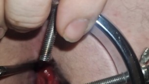NZ Kiwi Bear uses a butthole stretcher to see inside.