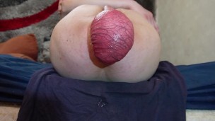 Pushing out 40 eggs, then pissing and prolapsing