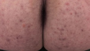 Cumming On My Own Ass Watch My Butthole Pulse
