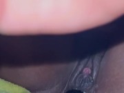 Alil gape clip 16/16