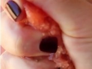 Let's get squeezed 6/16