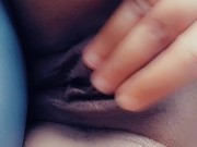 World's largest Clitoris 12/16