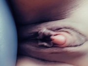 World's largest Clitoris 15/16