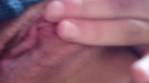 Vagina