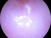 Camera dildo after a rough fuck and cream filling 3/16