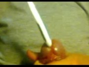Urethral insertion with toothbrush 2/16